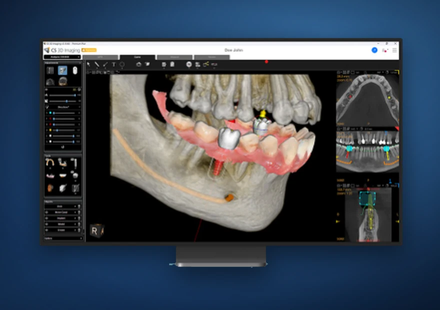 Software de planeamento digital com imagem DICOM