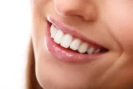 Sorriso alinhado e natural