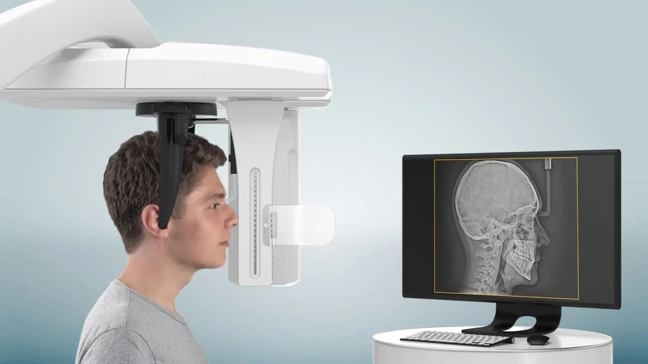 Jovem a realizar uma telerradiografia de perfil, com a imagem lateral do crânio no monitor